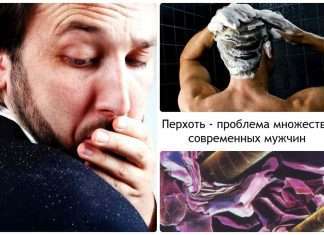 Кращий шампунь від лупи для чоловіків – особливості вибору, рейтинг, відгуки