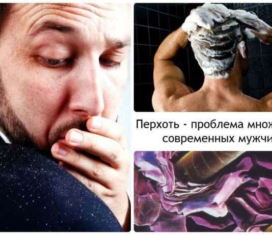 Кращий шампунь від лупи для чоловіків – особливості вибору, рейтинг, відгуки