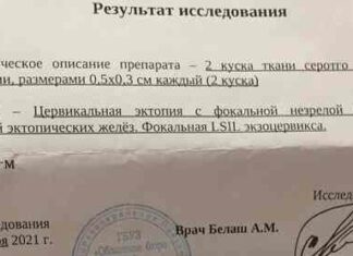 Sos, отриманий результат гістології шм, допоможіть розшифрувати
