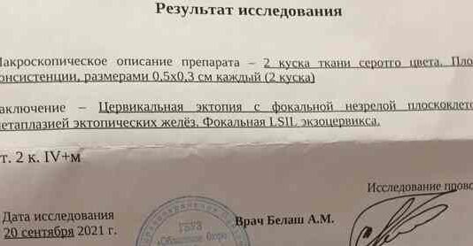 Sos, отриманий результат гістології шм, допоможіть розшифрувати