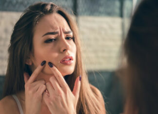 Чому не можна видавлювати прищі і чим це загрожує