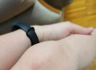 Допоможіть впізнати прищики))